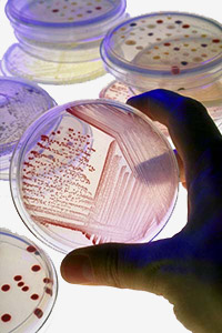 petri-dish with microbial (mold) growth